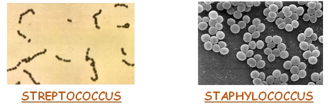 Cellulitis